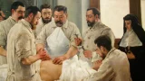 Histoire de la chirurgie
